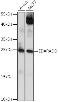 Western blot - EDARADD Polyclonal Antibody 