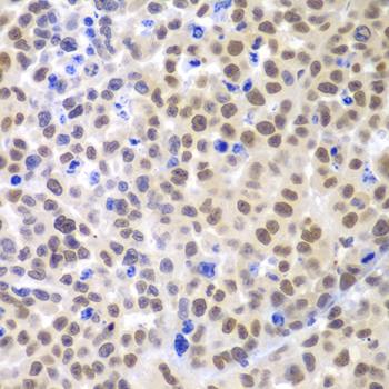Immunohistochemistry - LHX4 Polyclonal Antibody 