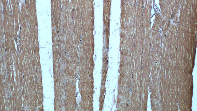 Immunohistochemical of paraffin-embedded human skeletal muscle using Catalog No:108921(CAMK2G antibody) at dilution of 1:50 (under 10x lens)