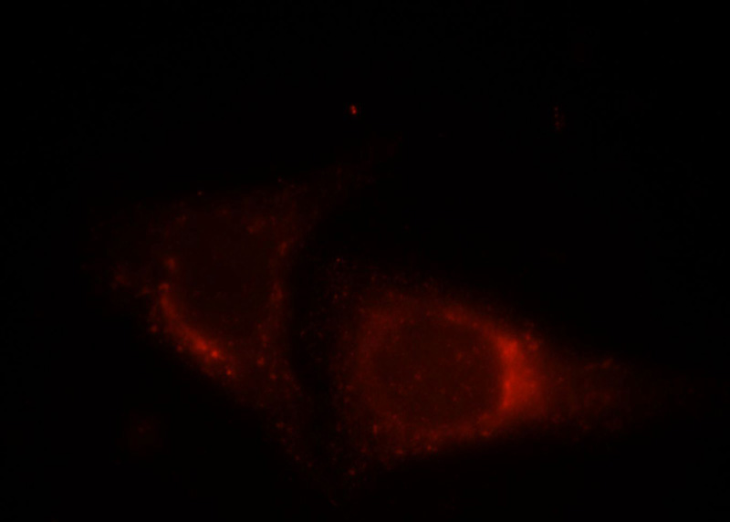 Immunofluorescent analysis of HepG2 cells, using STX8 antibody Catalog No:115801 at 1:25 dilution and Rhodamine-labeled goat anti-rabbit IgG (red).