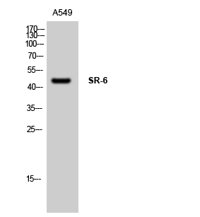 Fig1:; Western Blot analysis of A549 cells using SR-6 Polyclonal Antibody
