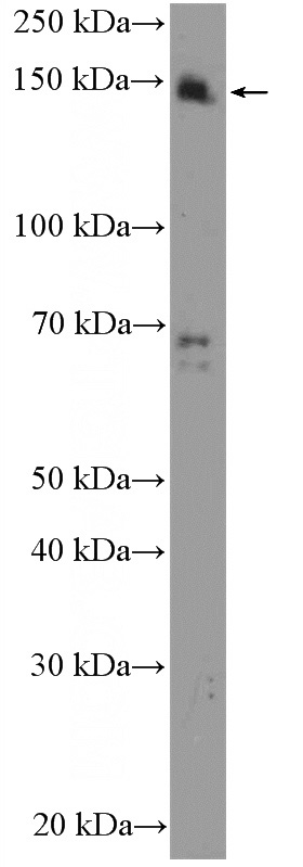 HeLa cells were subjected to SDS PAGE followed by western blot with Catalog No:115741(SUPT5H Antibody) at dilution of 1:600