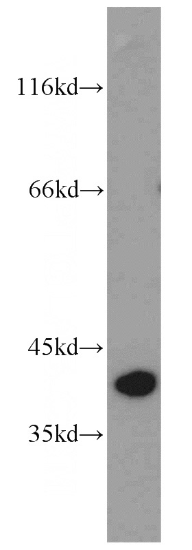 human stomach tissue were subjected to SDS PAGE followed by western blot with Catalog No:113709(PGC antibody) at dilution of 1:800