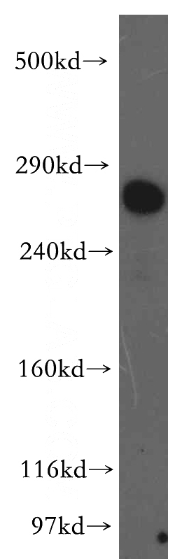 HEK-293 cells were subjected to SDS PAGE followed by western blot with Catalog No:112322(LRP2-Specific antibody) at dilution of 1:300