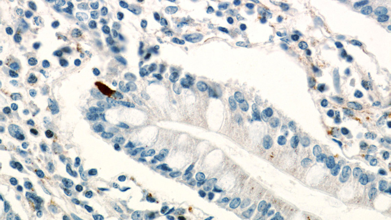 Immunohistochemical of paraffin-embedded human small intestine using Catalog No:112211(LGR5 antibody) at dilution of 1:200 (under 40x lens)