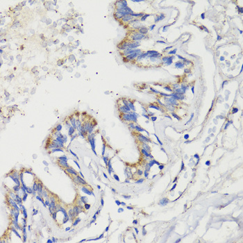 Immunohistochemistry - DEPDC6 Polyclonal Antibody 