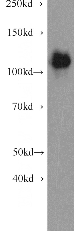 A549 cells were subjected to SDS PAGE followed by western blot with Catalog No:110243(EML4 antibody) at dilution of 1:2000
