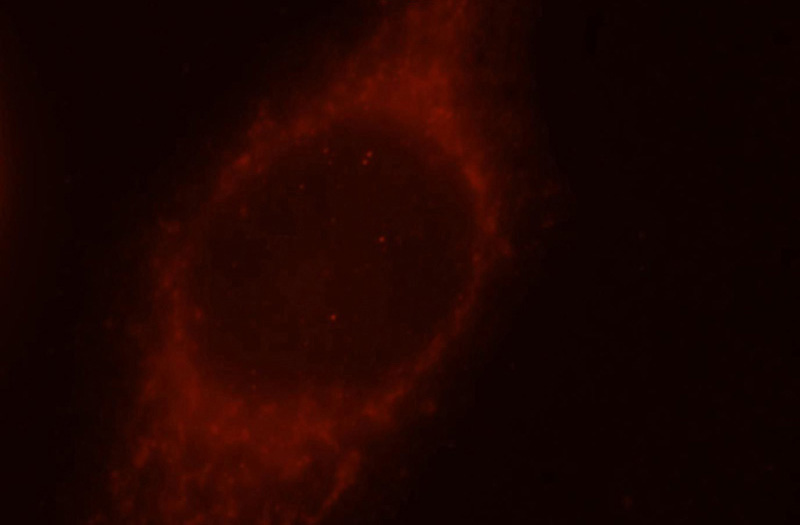 Immunofluorescent analysis of MCF-7 cells, using CCT7 antibody Catalog No:109036 at 1:25 dilution and Rhodamine-labeled goat anti-rabbit IgG (red).