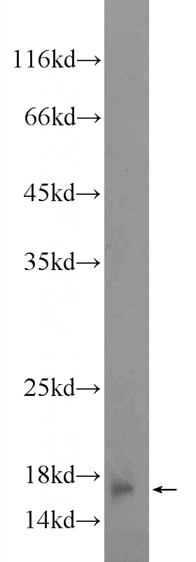 UV treated HeLa cells were subjected to SDS PAGE followed by western blot with Catalog No:110821(GADD45G Antibody) at dilution of 1:300