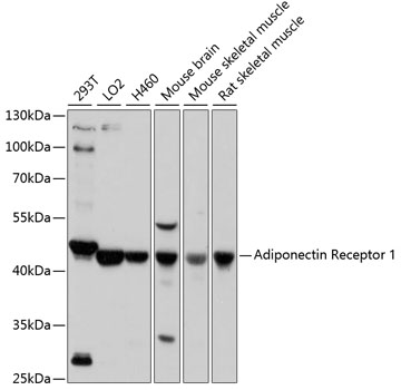 Western blot - Adiponectin Receptor 1 Polyclonal Antibody 