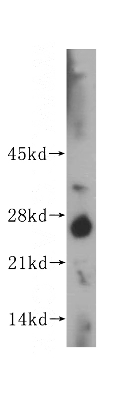 HeLa cells were subjected to SDS PAGE followed by western blot with Catalog No:113291(NOG antibody) at dilution of 1:500