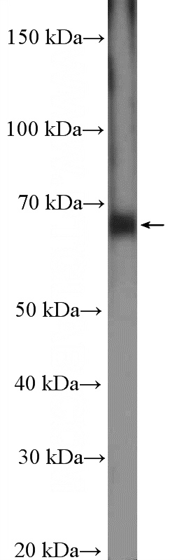 mouse spleen tissue were subjected to SDS PAGE followed by western blot with Catalog No:111258(HAS1 Antibody) at dilution of 1:300