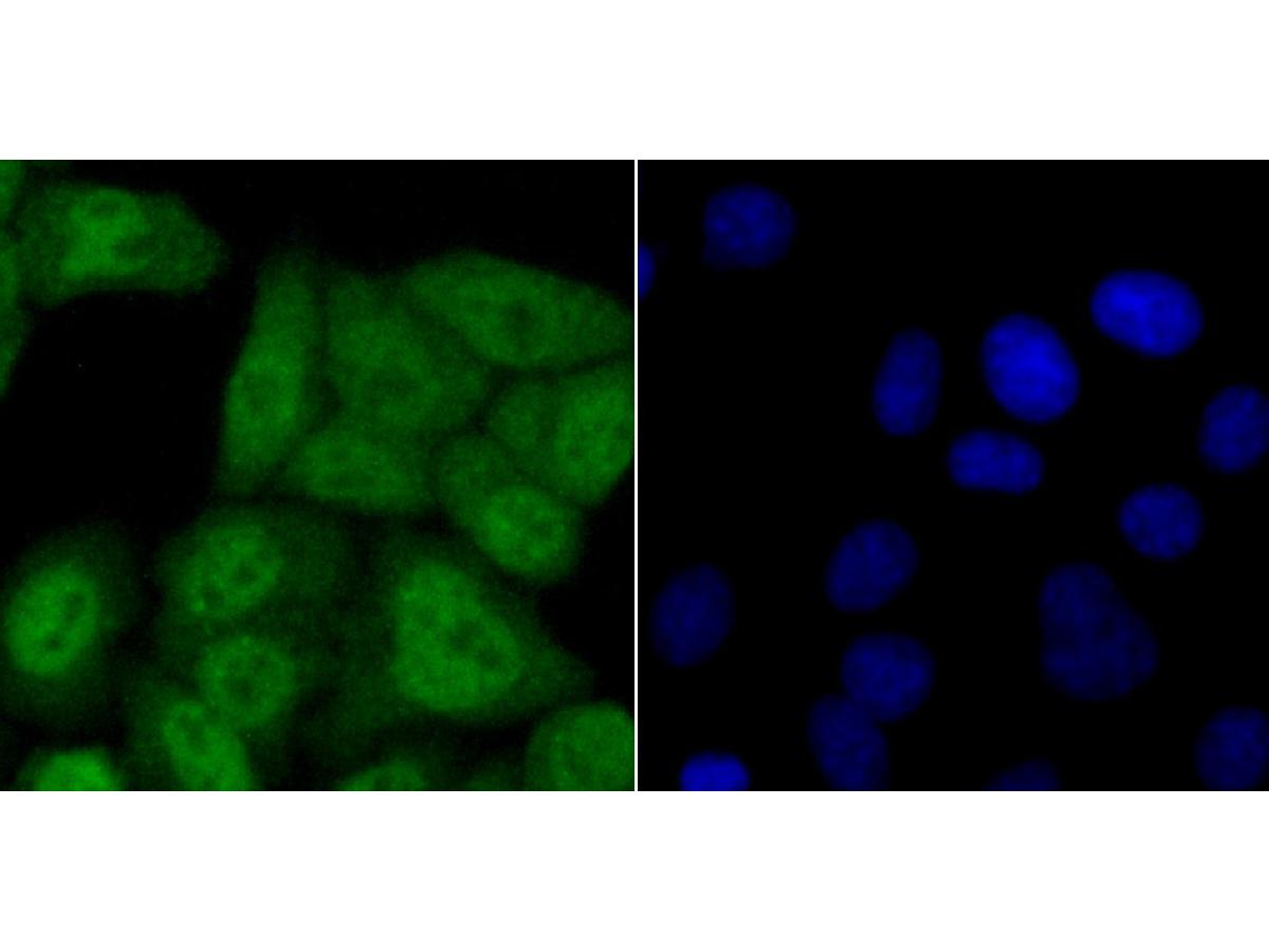 Fig3:; ICC staining of USP11 in HepG2 cells (green). Formalin fixed cells were permeabilized with 0.1% Triton X-100 in TBS for 10 minutes at room temperature and blocked with 10% negative goat serum for 15 minutes at room temperature. Cells were probed with the primary antibody ( 1/50) for 1 hour at room temperature, washed with PBS. Alexa Fluor®488 conjugate-Goat anti-Rabbit IgG was used as the secondary antibody at 1/1,000 dilution. The nuclear counter stain is DAPI (blue).