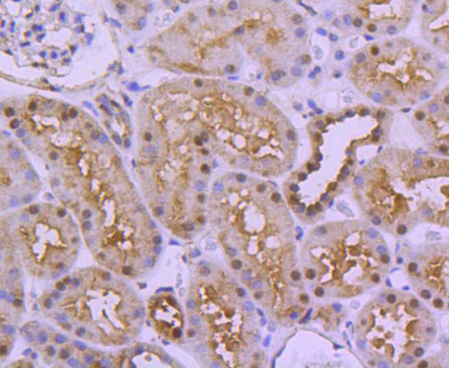 Fig6:; Immunohistochemical analysis of paraffin-embedded human kidney tissue using anti-Ubiquitin-like modifier-activating enzyme 1 antibody. The section was pre-treated using heat mediated antigen retrieval with Tris-EDTA buffer (pH 8.0-8.4) for 20 minutes.The tissues were blocked in 5% BSA for 30 minutes at room temperature, washed with ddH; 2; O and PBS, and then probed with the primary antibody ( 1/50) for 30 minutes at room temperature. The detection was performed using an HRP conjugated compact polymer system. DAB was used as the chromogen. Tissues were counterstained with hematoxylin and mounted with DPX.