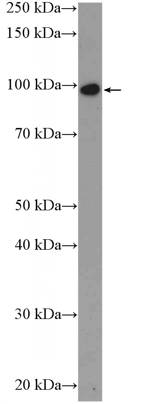 mouse heart tissue were subjected to SDS PAGE followed by western blot with Catalog No:117167(ZNF366 Antibody) at dilution of 1:300