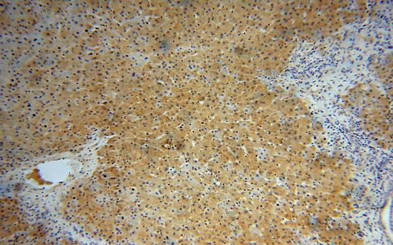 Immunohistochemical of paraffin-embedded human liver using Catalog No:110853(GALT antibody) at dilution of 1:100 (under 10x lens)