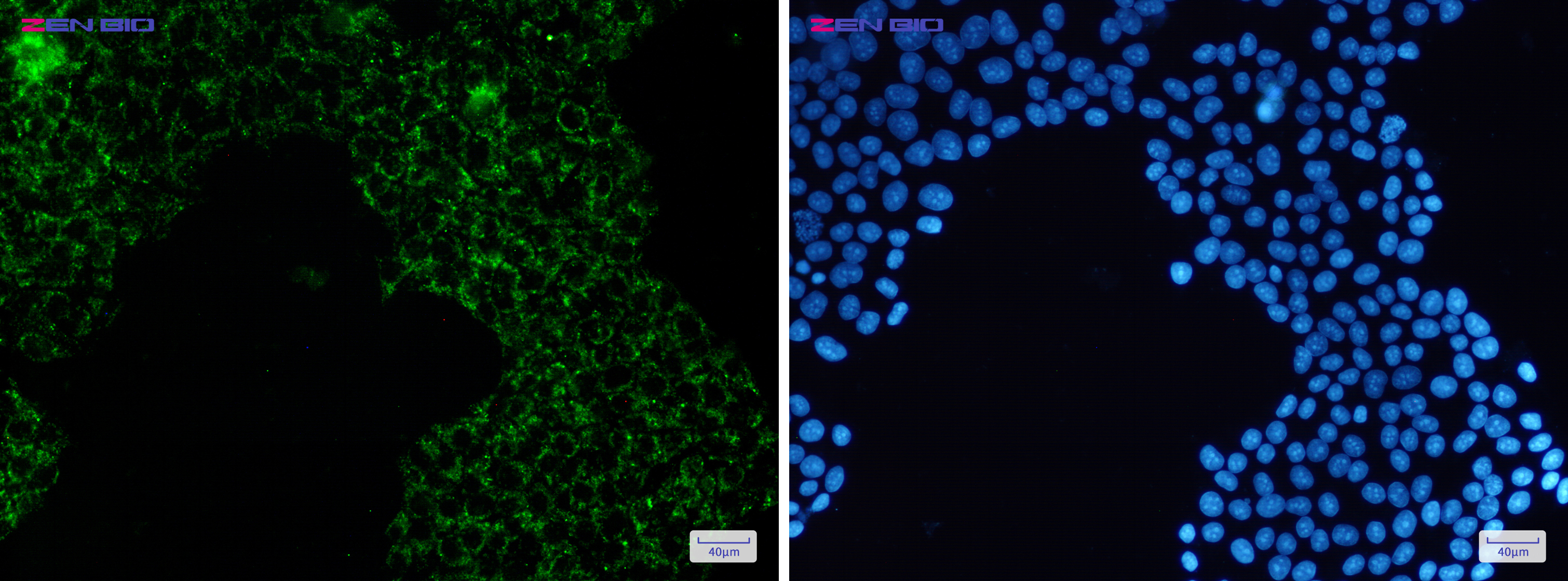 Immunocytochemistry of Pyruvate Dehydrogenase E1-alpha subunit(green) in Hela cells using Pyruvate Dehydrogenase E1-alpha subunit Rabbit pAb at dilution 1/50, and DAPI(blue)