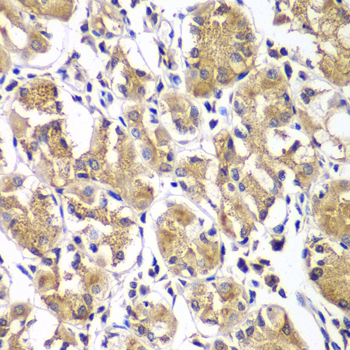 Immunohistochemistry - DGKE Polyclonal Antibody 
