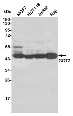 Western blot detection of GOT2 in MCF7,HCT116,Jurkat and Raji cell lysates using GOT2 mouse mAb (1:1000 diluted).Predicted band size:47KDa.Observed band size:47KDa.