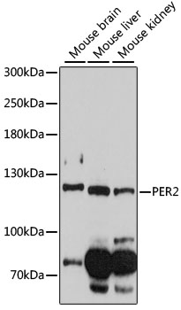 Western blot - PER2 Polyclonal Antibody 