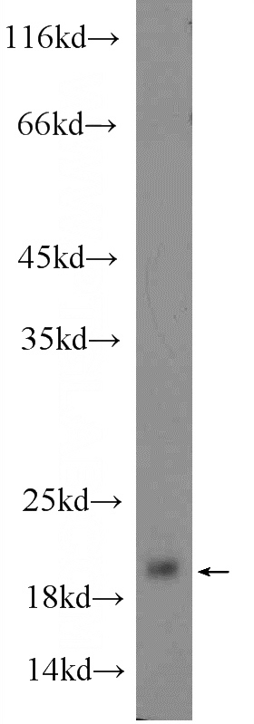 mouse stomach tissue were subjected to SDS PAGE followed by western blot with Catalog No:111018(GKN2 Antibody) at dilution of 1:1000