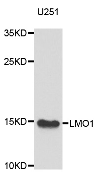 Western blot - LMO1 Polyclonal Antibody 