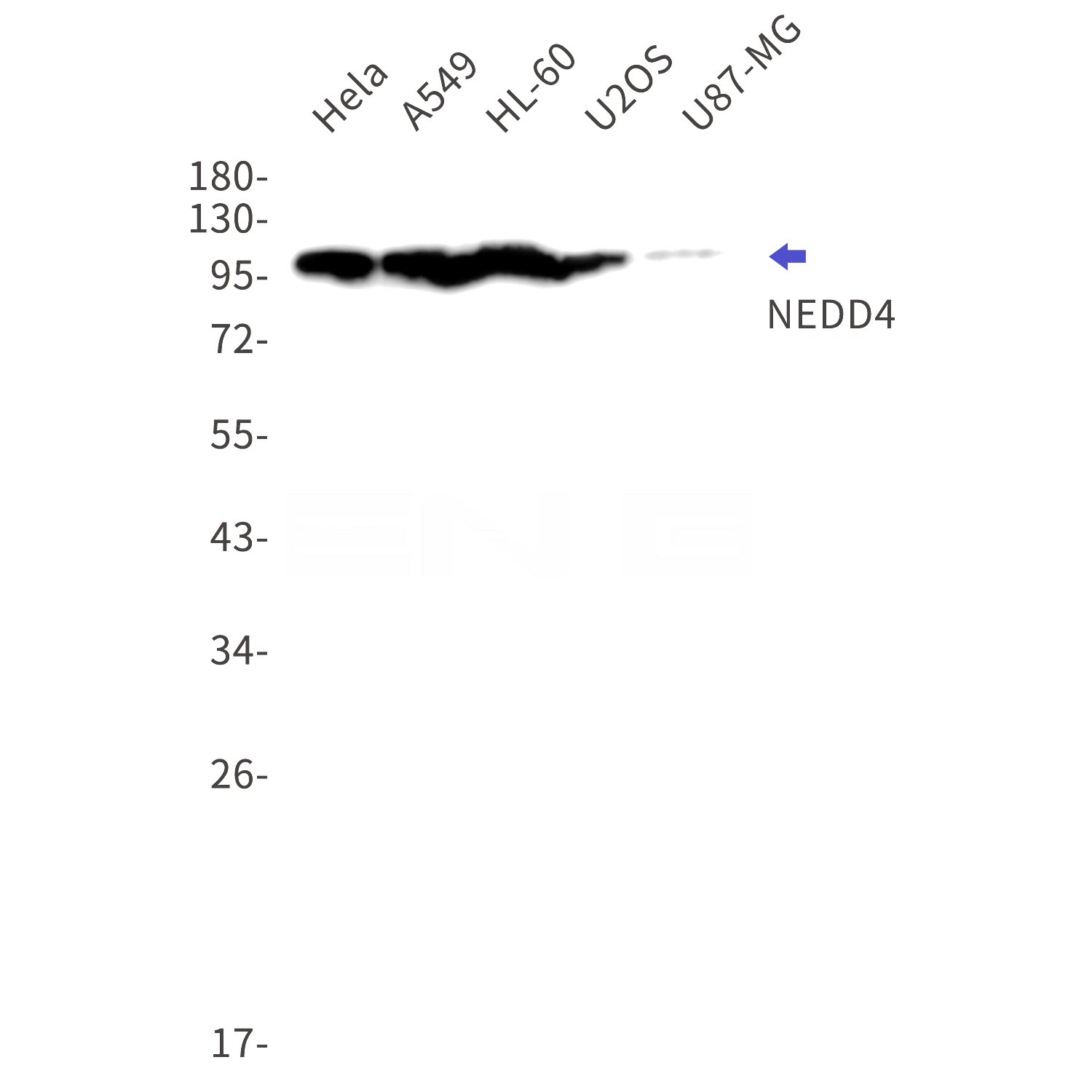 Western blot detection of NEDD4 in Hela,A549,HL-60,U2OS,U87-MG cell lysates using NEDD4 Rabbit mAb(1:1000 diluted).Predicted band size:149kDa.Observed band size:115kDa.