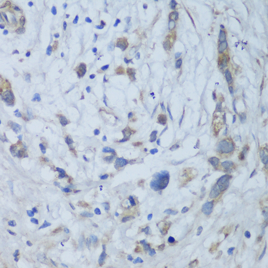 Immunohistochemistry - CEMIP Polyclonal Antibody 