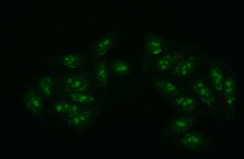 Immunofluorescent analysis of (10% Formaldehyde) fixed HepG2 cells using Catalog No:109838(DDX52 Antibody) at dilution of 1:50 and Alexa Fluor 488-congugated AffiniPure Goat Anti-Rabbit IgG(H+L)