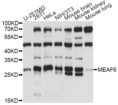 Western blot - MEAF6 Polyclonal Antibody 