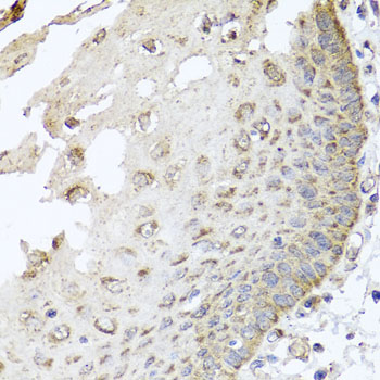 Immunohistochemistry - IRS2 Polyclonal Antibody 