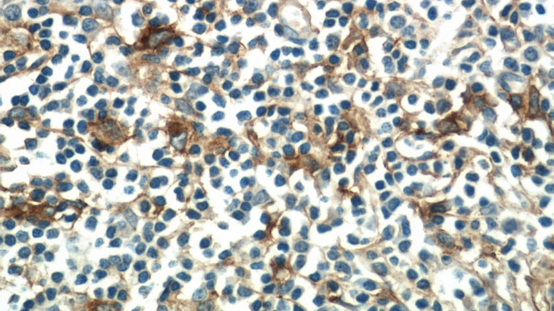 Immunohistochemistry of paraffin-embedded human tonsillitis tissue slide using (ANPEP Antibody) at dilution of 1:100 (under 40x lens)