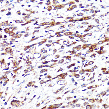 Immunohistochemistry - CNR1 Polyclonal Antibody 