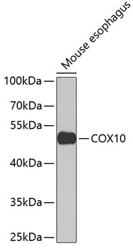Western blot - COX10 Polyclonal Antibody 