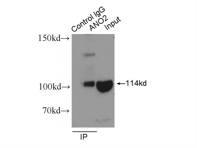 IP Result of anti-ANO2 (IP:Catalog No:108101, 4ug; Detection:Catalog No:108101 1:300) with mouse brain tissue lysate 10000ug.