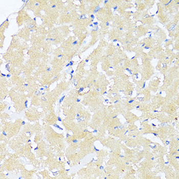 Immunohistochemistry - TGFB2 Polyclonal Antibody 