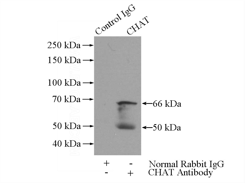 IP Result of anti-CHAT (IP:Catalog No:109208, 4ug; Detection:Catalog No:109208 1:300) with rat brain tissue lysate 4000ug.