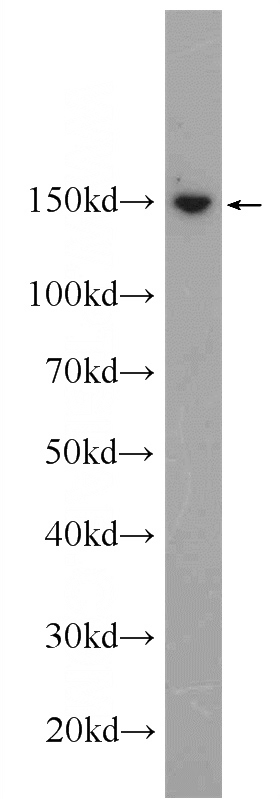 MCF-7 cells were subjected to SDS PAGE followed by western blot with Catalog No:115043(SAFB Antibody) at dilution of 1:1000