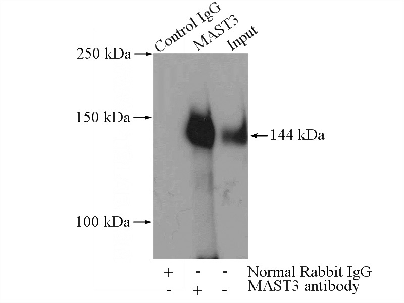 IP Result of anti-MAST3 (IP:Catalog No:112491, 4ug; Detection:Catalog No:112491 1:500) with Jurkat cells lysate 4000ug.
