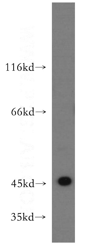 HeLa cells were subjected to SDS PAGE followed by western blot with Catalog No:114739(RNF133 antibody) at dilution of 1:500