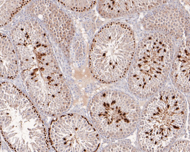 Fig3:; Immunohistochemical analysis of paraffin-embedded mouse testis tissue using anti-XRCC2 antibody. The section was pre-treated using heat mediated antigen retrieval with sodium citrate buffer (pH 6.0) for 20 minutes. The tissues were blocked in 5% BSA for 30 minutes at room temperature, washed with ddH; 2; O and PBS, and then probed with the primary antibody ( 1/400) for 30 minutes at room temperature. The detection was performed using an HRP conjugated compact polymer system. DAB was used as the chromogen. Tissues were counterstained with hematoxylin and mounted with DPX.