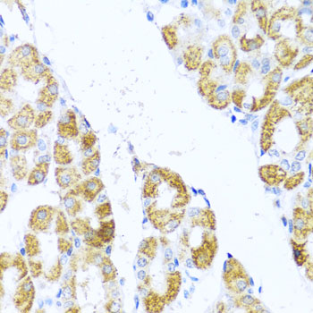 Immunohistochemistry - MOK Polyclonal Antibody 