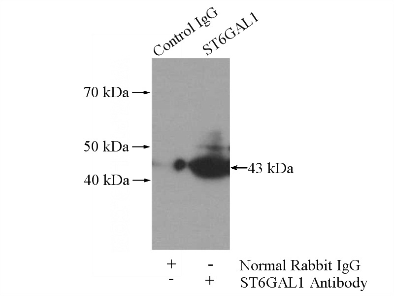 IP Result of anti-ST6GAL1 (IP:Catalog No:115628, 4ug; Detection:Catalog No:115628 1:600) with Raji cells lysate 2800ug.