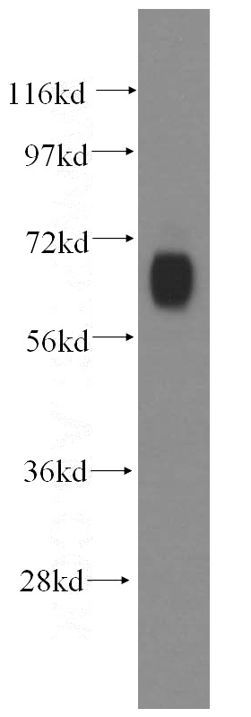 human brain tissue were subjected to SDS PAGE followed by western blot with Catalog No:110811(GABRD antibody) at dilution of 1:500