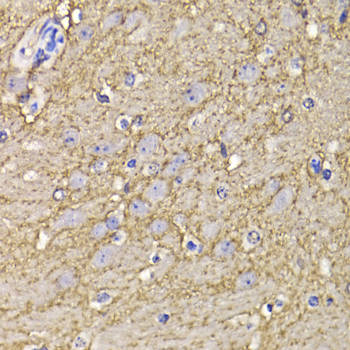 Immunohistochemistry - KCND3 Polyclonal Antibody 