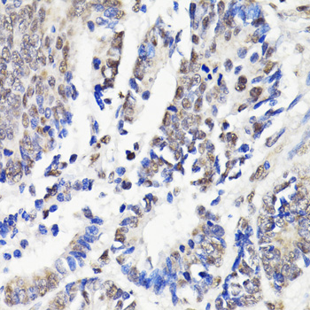 Immunohistochemistry - NAV2 Polyclonal Antibody 