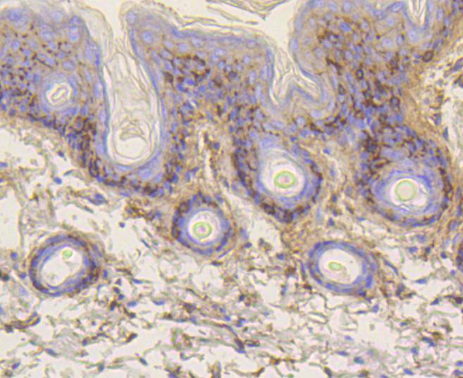 Fig9:; Immunohistochemical analysis of paraffin-embedded mouse skin tissue using anti-Vitronectin antibody. The section was pre-treated using heat mediated antigen retrieval with Tris-EDTA buffer (pH 8.0-8.4) for 20 minutes.The tissues were blocked in 5% BSA for 30 minutes at room temperature, washed with ddH; 2; O and PBS, and then probed with the primary antibody ( 1/50) for 30 minutes at room temperature. The detection was performed using an HRP conjugated compact polymer system. DAB was used as the chromogen. Tissues were counterstained with hematoxylin and mounted with DPX.