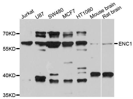 Western blot - ENC1 Polyclonal Antibody 