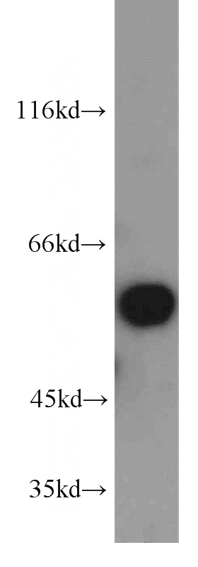 mouse brain tissue were subjected to SDS PAGE followed by western blot with Catalog No:114109(PPP3CA antibody) at dilution of 1:300