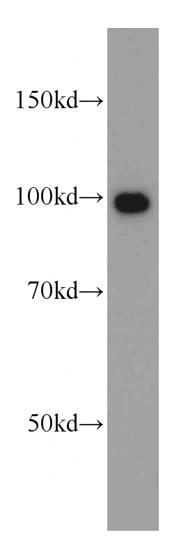 PC-3 cells were subjected to SDS PAGE followed by western blot with Catalog No:116782(PIK3C3 antibody) at dilution of 1:400